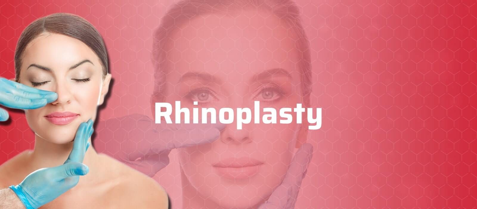 Rhinoplasty
