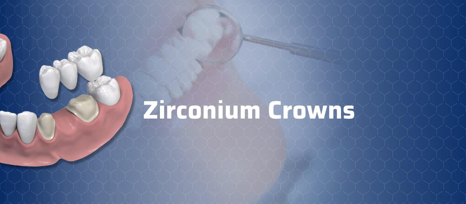 Zirconium Crowns