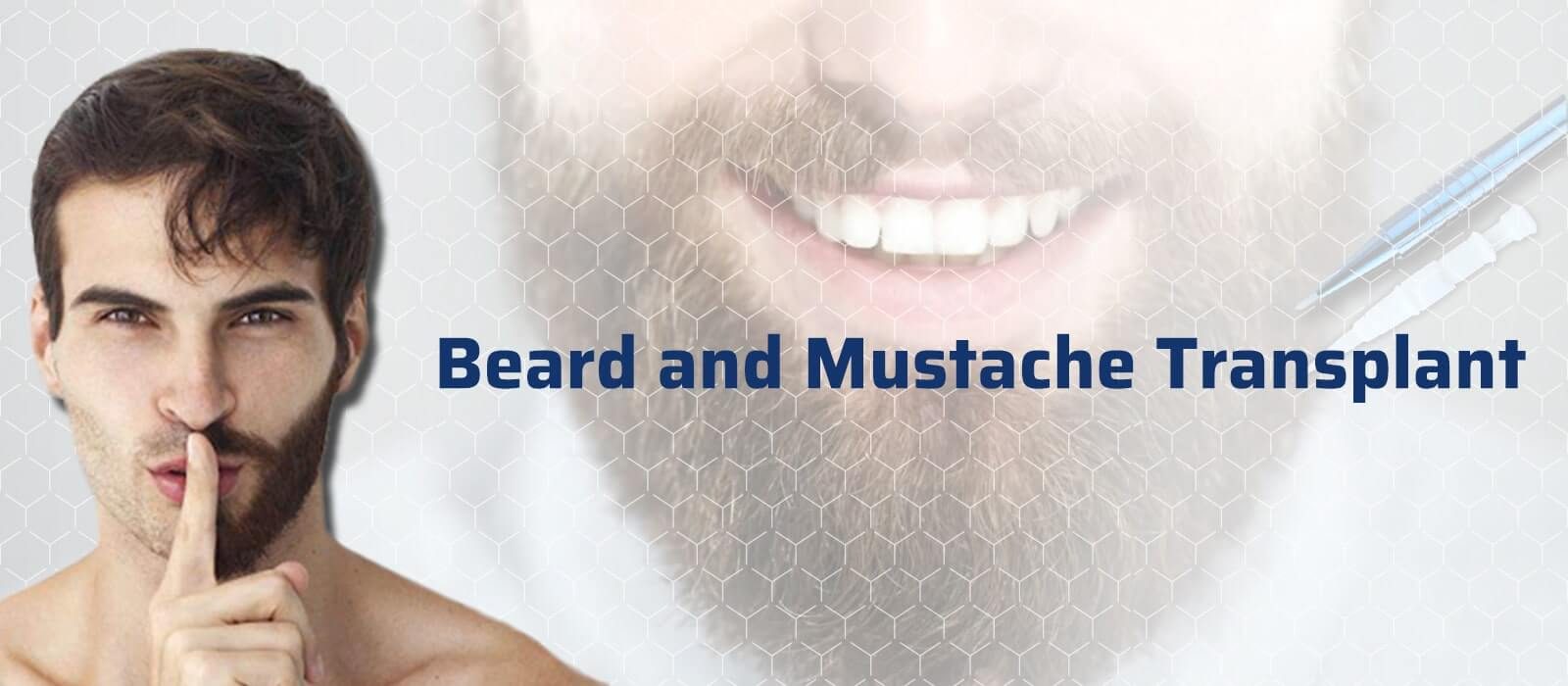 Beard and Mustache Transplant