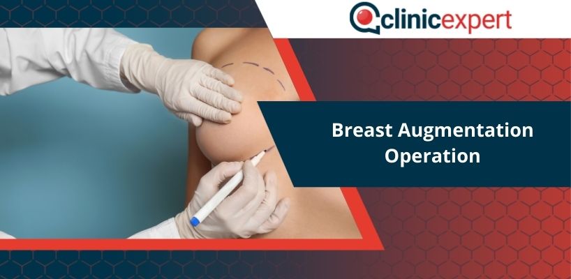 Breast Augmentation Operation