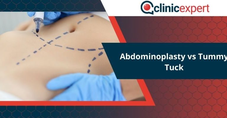 Abdominoplasty vs Tummy Tuck