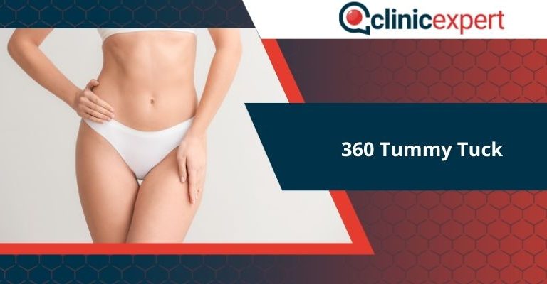 360 Tummy Tuck