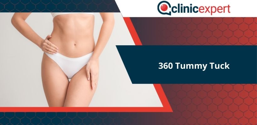 360 Tummy Tuck