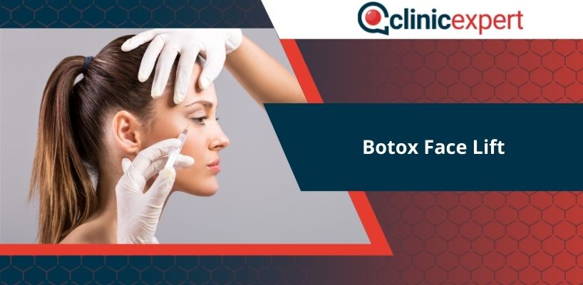 Botox face lift