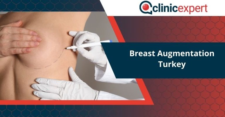 Breast Augmentation Turkey
