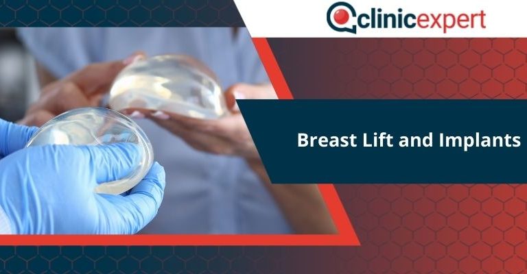 Breast Lift and Implants