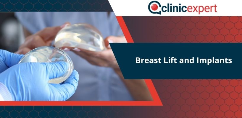 Breast Lift and Implants