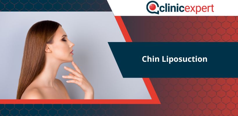 Chin liposiction