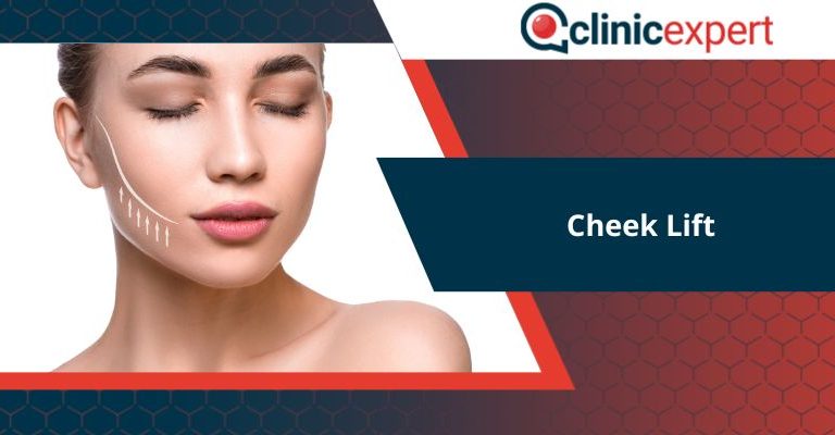 Cheek Lift