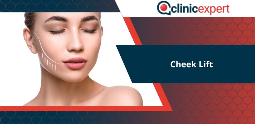 Cheek Lift