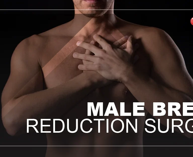 male-breast-reduction