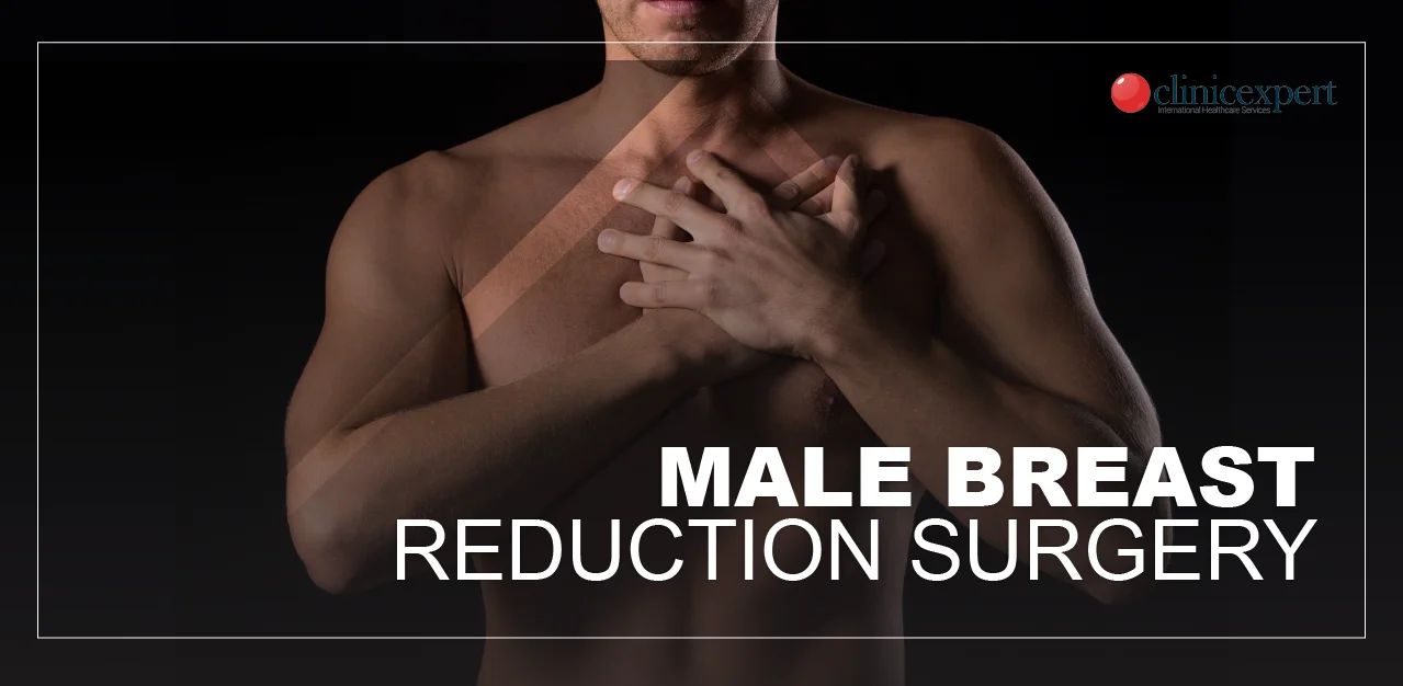 male-breast-reduction