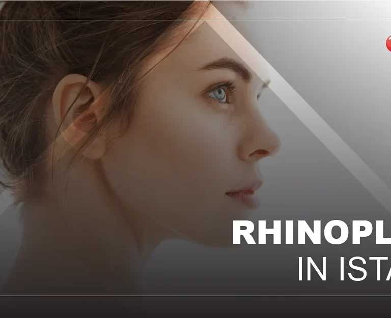 Rhinoplasty in Istanbul