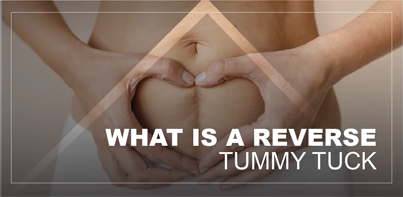 reverse-tummy-tuck