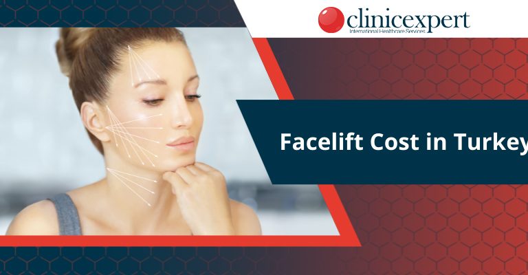 Facelift Cost in Turkey