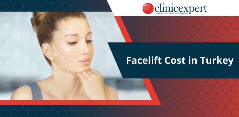 Facelift Cost in Turkey