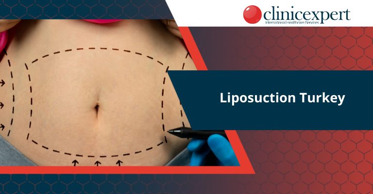 Liposuction Turkey