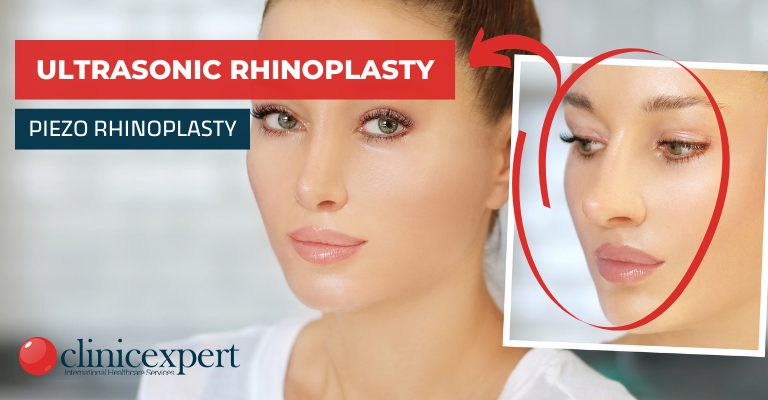 Ultrasonic Rhinoplasty / Piezo Rhinoplasty