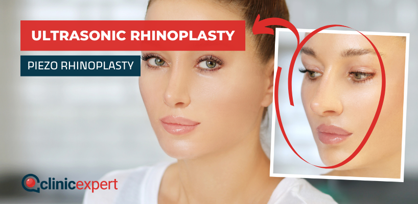 Ultrasonic Rhinoplasty / Piezo Rhinoplasty