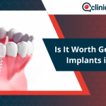 Is It Worth Getting Dental Implants in Turkey?