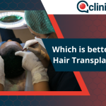 Which Is Better: FUE or DHI Hair Transplant in Turkey?