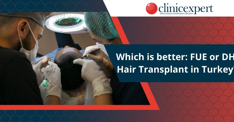 Which Is better FUE or DHI Hair Transplant in Turkey