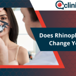 Does Rhinoplasty Change Your Face?