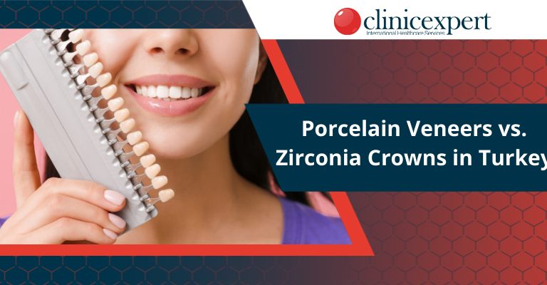 Porcelain Veneers vs Zirconium Crowns in Turkey