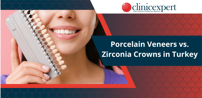 Porcelain Veneers vs Zirconium Crowns in Turkey