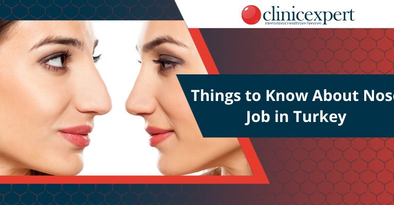 Things to Know About Nose Job in Turkey