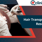 Hair Transplant Turkey Results