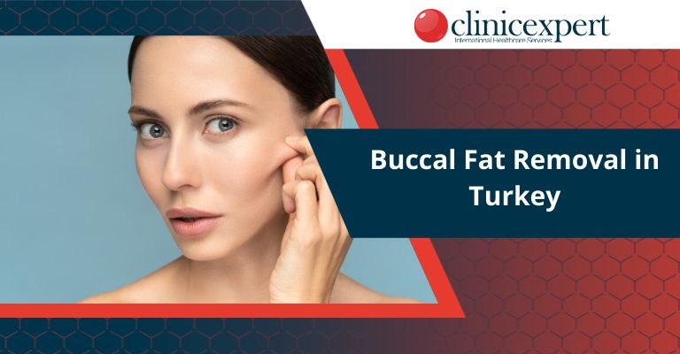 Buccal Fat Removal in Turkey