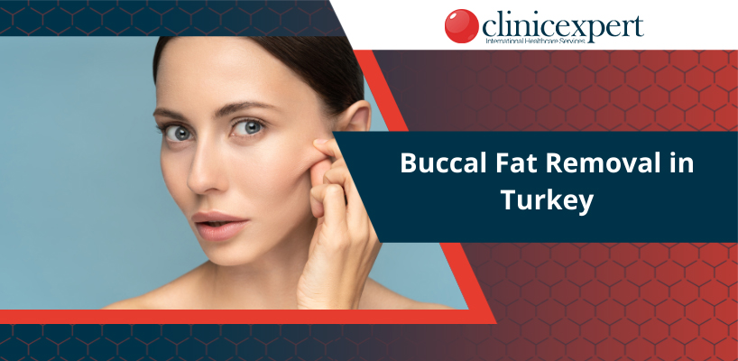 Buccal Fat Removal in Turkey