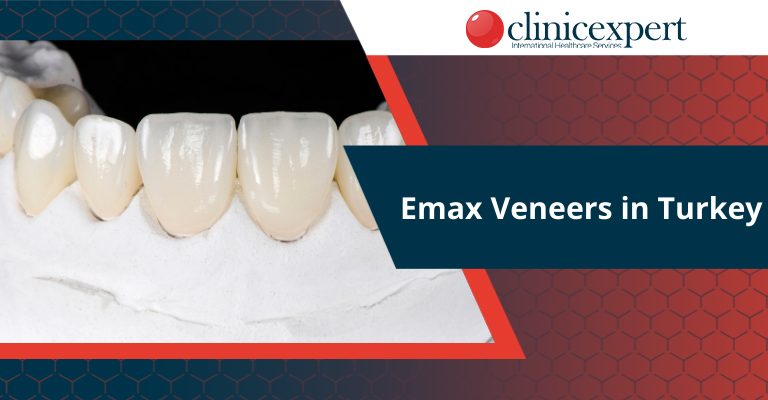 E-Max Veneers in Turkey