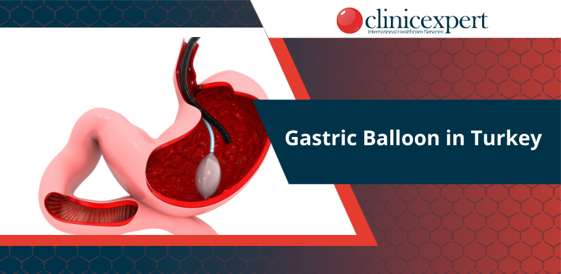 Gastric Balloon in Turkey