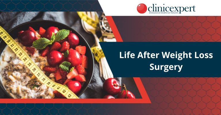 Life After Weight Loss Surgery