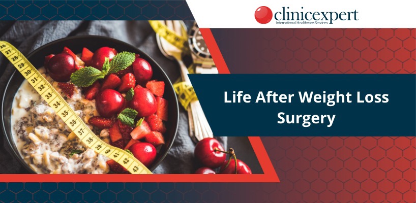 Life After Weight Loss Surgery