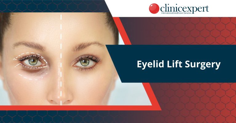 Eyelid Lift Surgery
