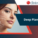 Deep Plane Facelift