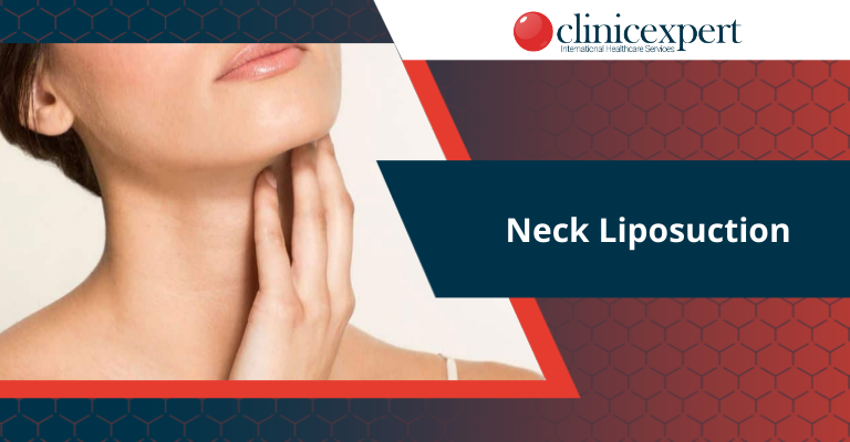 Neck Liposuction