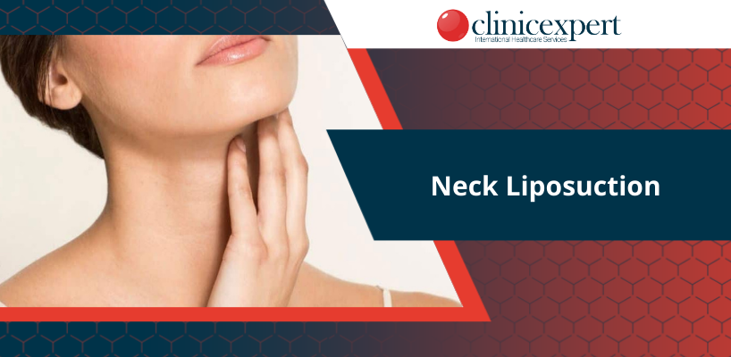 Neck Liposuction