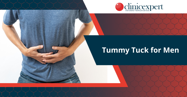 Tummy Tuck for Men