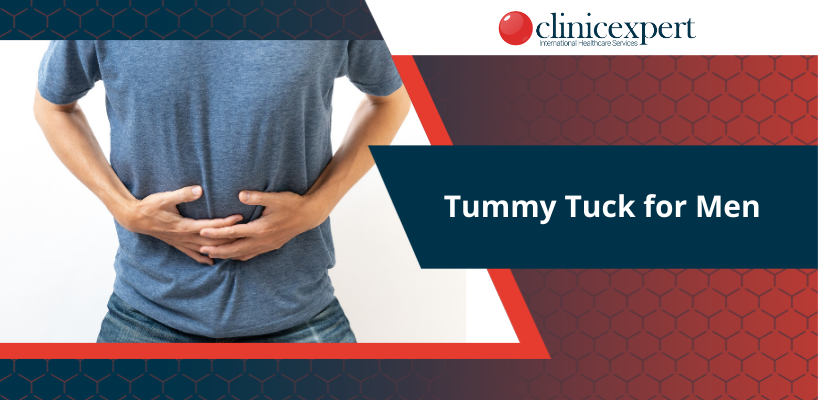 Tummy Tuck for Men