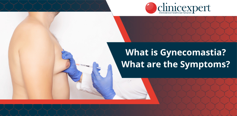 What is Gynecomastia?