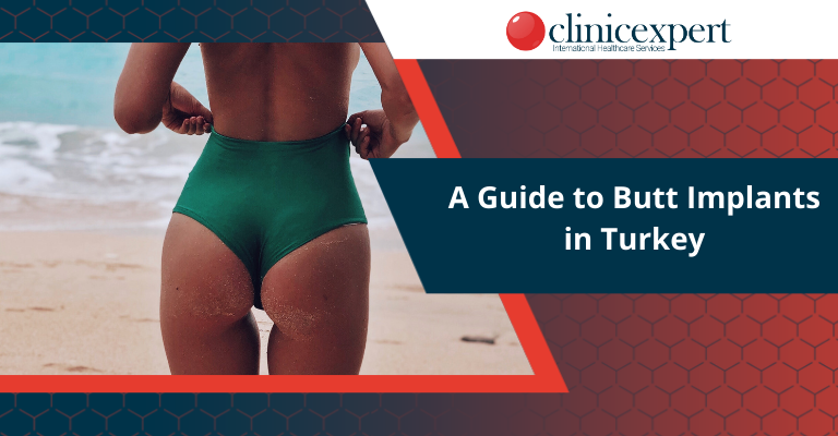 A Guide to Butt Implants in Turkey