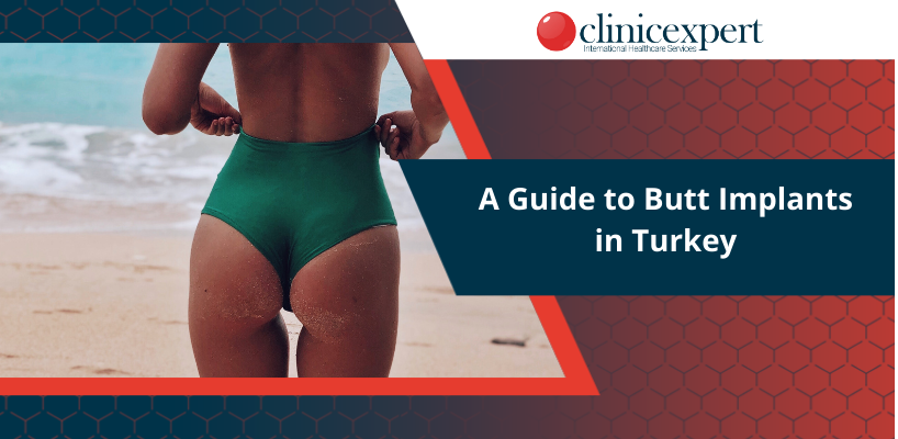 A Guide to Butt Implants in Turkey