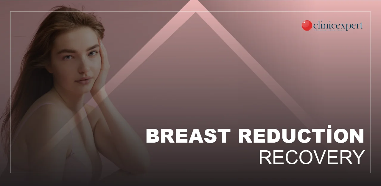 Breast Reduction Recovery