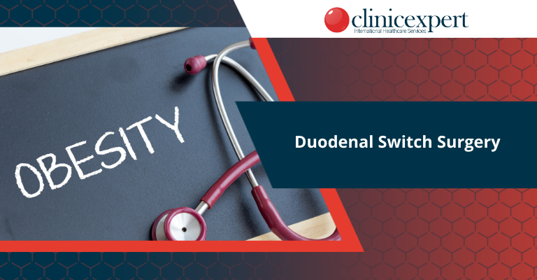 Duodenal Switch Surgery
