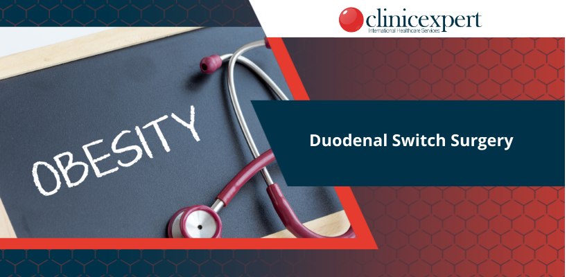 Duodenal Switch Surgery