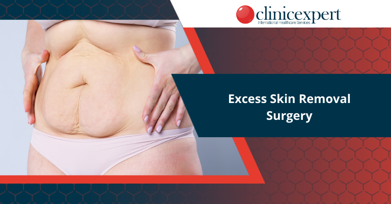 Excess Skin Removal Surgery